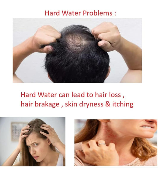 Can Hard Water Cause Dry, Itchy Skin or a Flaky Scalp?